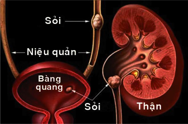 nước cứng